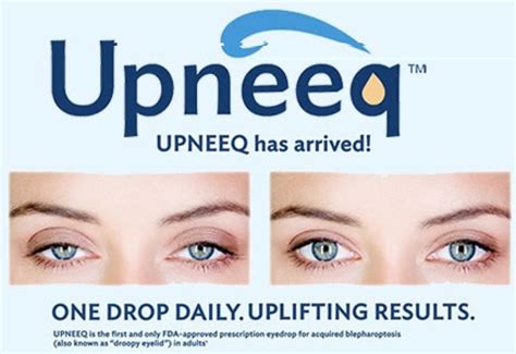 Upneeq Eye Drops Price