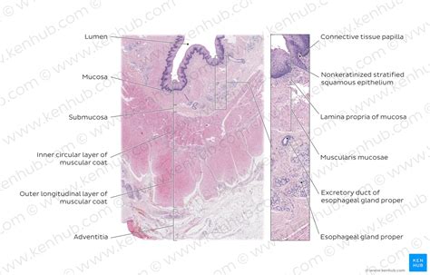 Upper digestive tract: Histology and clinical aspects