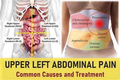 Upper left abdominal pain that comes and goes.  Common causes include a...