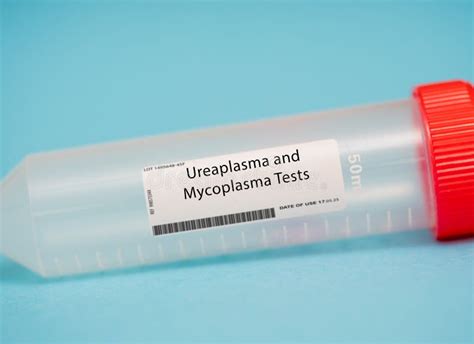 Ureaplasma Test