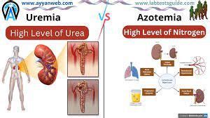 Uremia VS Azotemia Definations, Differences And Others LTG