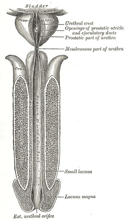 Urethral stricture - Wikipedia