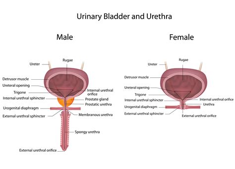 Urethritis - Knowledge @ AMBOSS