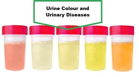 Urine Color: What Does It Mean? - Helal Medical