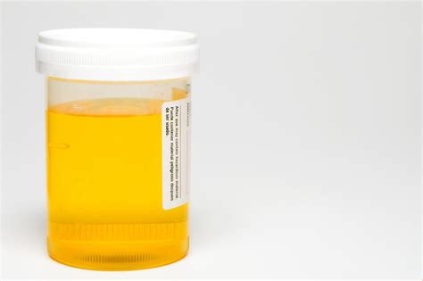 Female Urine Smells Like Sulfur. UTIs typically occur as a result of 