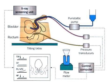 Urodynamic Testing Procedure