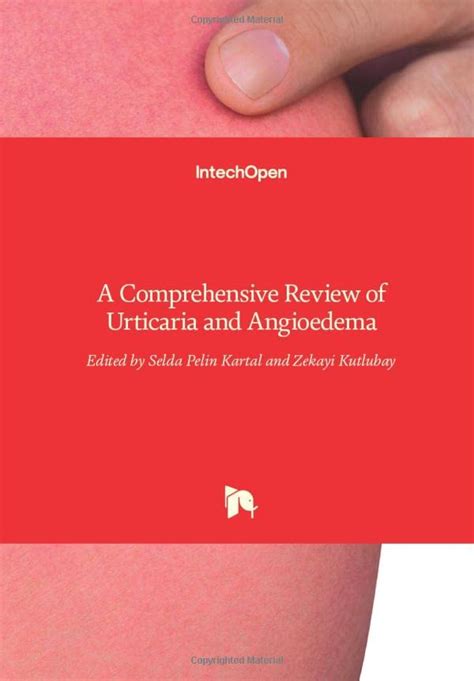 Urticaria: A comprehensive review: - ScienceDirect