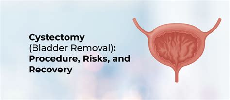 Useful Tips for Bladder Surgery Recovery
