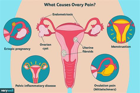 Having a uterus comes with its own health conditi
