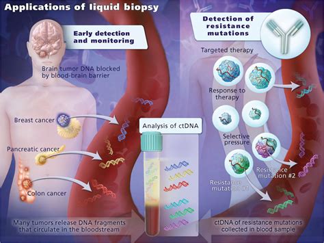 Utility of circulating tumor DNA for detection and …