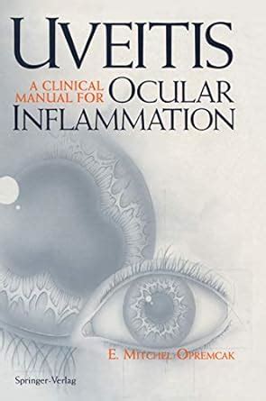 Uveitis a clinical manual for ocular inflammation 1st edition. - Diseño manual de shearwall en el ejemplo etabs.