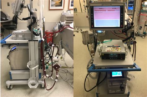 VA ECMO The Patient Guide to Heart, Lung, and Esophageal …