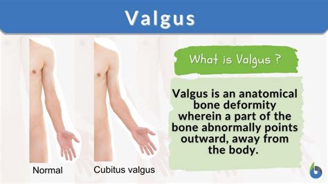 VAGUS definition in the Cambridge English Dictionary