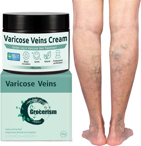 Varicose Vein Cream - for Legs Reduces Spider Veins and Heaviness … - balustradellc