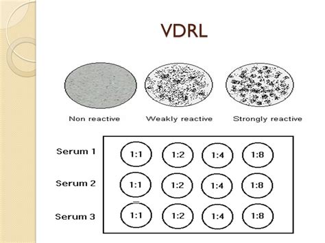 VDRL .