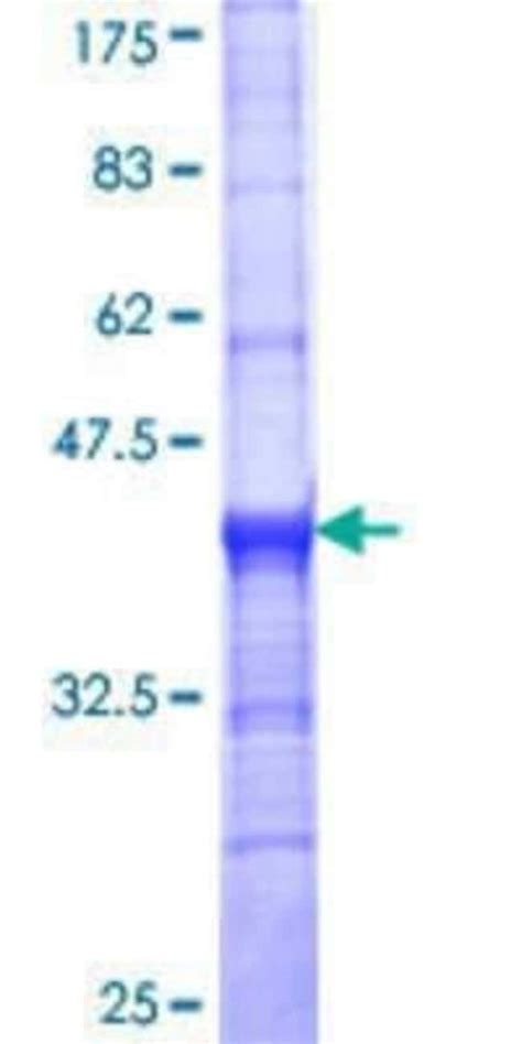 VMAT2 Research Products: Novus Biologicals