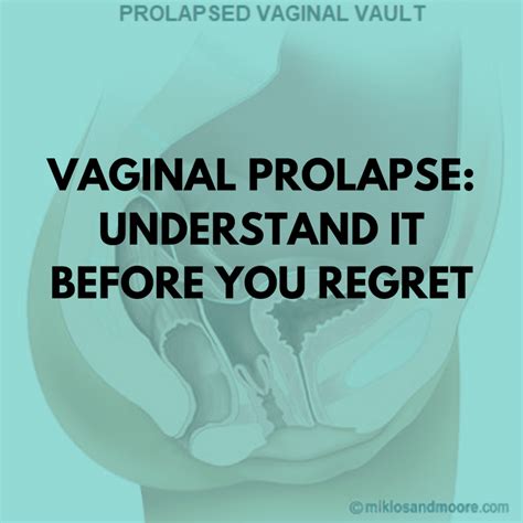 Vaginal porn. Things To Know About Vaginal porn. 