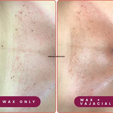 Sep 10, 2021 · There are a lot of benefits to getting a professional vajacial treatment following a wax. The main benefits of a vajacial include having clearer, less irritated skin following a wax. Additionally, vajacials aid in getting rid of existing ingrown hairs and preventing new ones from forming after a waxing treatment. . 
