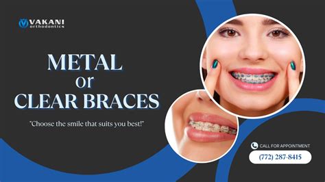 Vakani orthodontics. Our Port St Lucie Orthodontist offers affordable braces and Invisalign treatments to all Port St Lucie, Florida 34953. Orthodontist Stuart, Port St. Lucie, Ft Pierce, Vero Beach, Palm Bay. FREE Orthodontic Consultation & Best Prices! Facebook Instagram Youtube. 