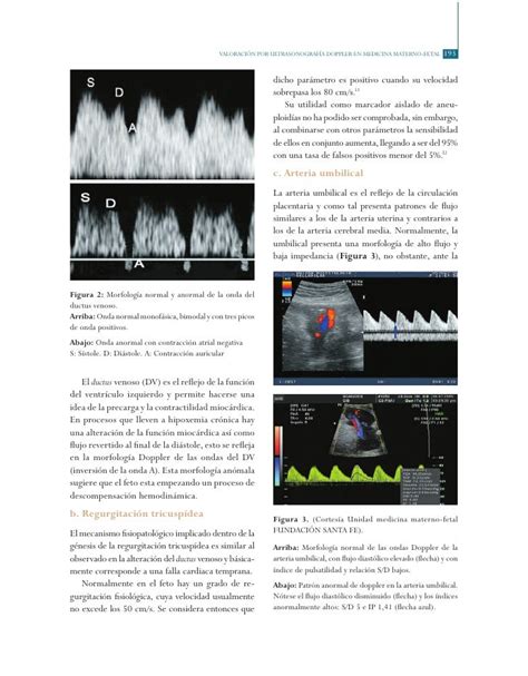 Valoración por ultrasonografía Doppler en medicina materno-fetal