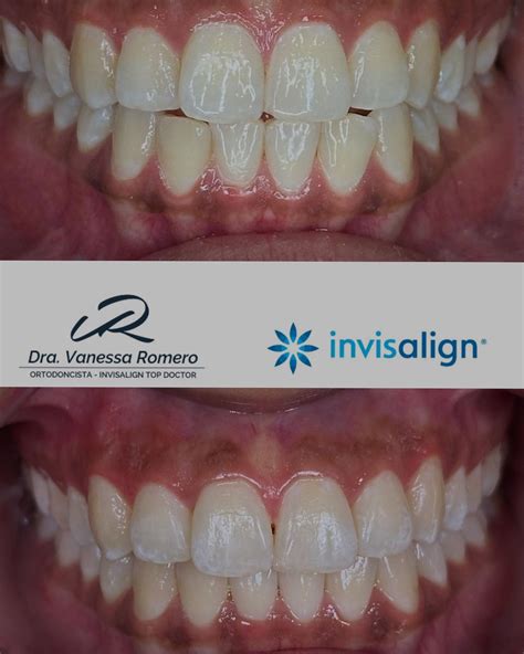 Vanessaromero Onlyfans Leak 🍌 +18