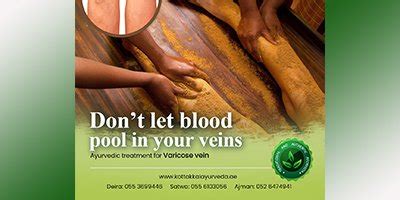 Varicose Vein Treatment - kottakkalayurveda.ae