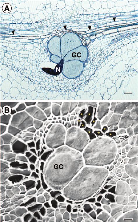 Vascularization and nutrient delivery at root-knot nematode …