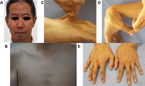 Veds facial features. .  <a href=https://id.paykar.tj/assets/images/6kf3/samenwonen-met-vrien...