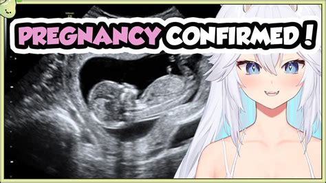 Veibae streams at : https://www.twitch.tv/Veibae. Follow along using the transcript. Veibae talks about pregnancy rumoursIf you like the video please consider liking and subscribing for.... 