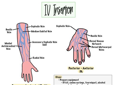 Veins for iv insertion.  Learn about the types of IV administration, their us...