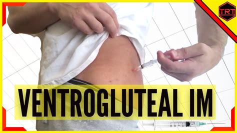 Ventrogluteal injection video. A ventrogluteal injection is an IM injection into an area on the side of your hip known as the ventrogluteal site. Keep reading to learn about the benefits of ventrogluteal injections and... 