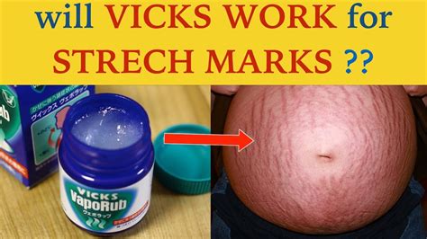 Vicks for stretch marks while pregnant.  And even if your nail condition...