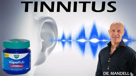 vicks vaporub for tinnitus. Tinnitus describes a ringing in the ears that typically accompanies hearing loss. Based upon the data from the Hearing Health …. 