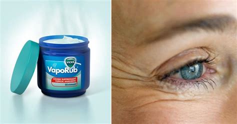 Vicks vaporub for wrinkles. Is Vicks VapoRub good for your face? For years people have claimed that Vicks Vapor Rub improves wrinkles, sagging skin, stretch marks and mosquito bites. Is... 