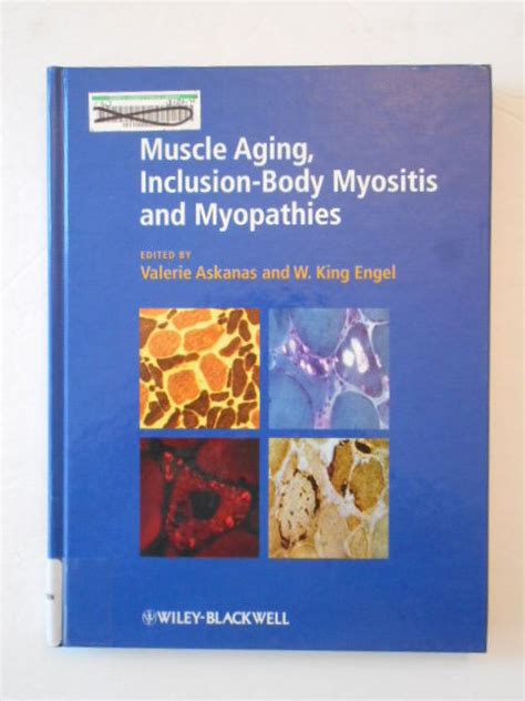 Vieillissement musculaire inclus myosite et myopathies relié 2012 par valerie askanaseditor. - Zimsec olevel science revision guide text.