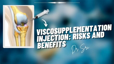 Viscosupplementation Knee Injection - YouTube