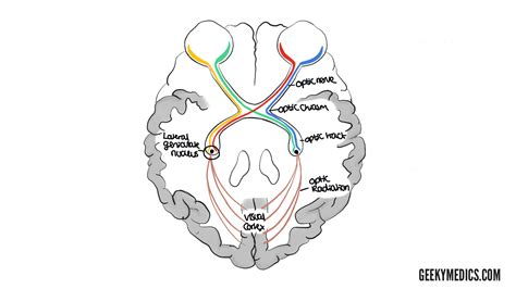 Visual Pathway and Visual Field Defects Geeky Medics