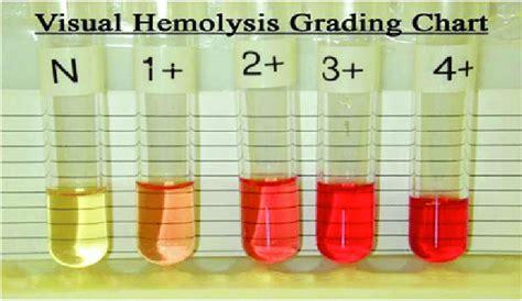 Visual grading for serum and plasma. Color images