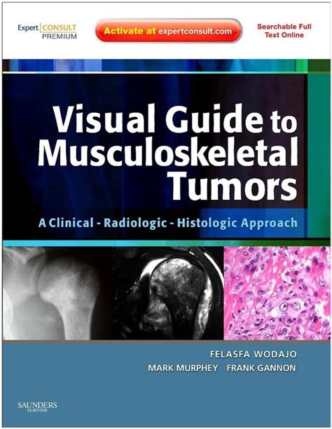 Visual guide to musculoskeletal tumors a clinical radiologic histologic approach expert consult online and print 1e. - Formwork a guide to good practice download.