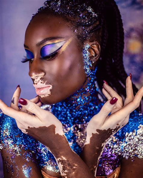 Vitiligo Babe. @Atladri Onlyfans Leaked XxX 🍌 231 Photos