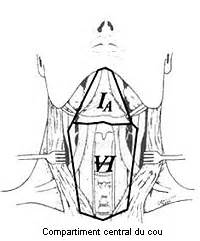 Vivre sans thyroïde: Curage jugulo carotidien