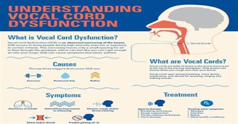 Vocal cord dysfunction Symptoms causes and more