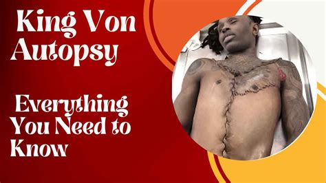 Von autopsy picture. Things To Know About Von autopsy picture. 