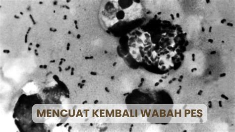 Wabah Pes - Penyebab, Gejala, Diagnosis, dan Pengobatan - wintechmobiles.com