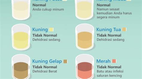 Warna Urine Putih Bening - balustradellc