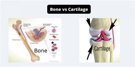 What are the differences between rigging with bones using bones ... - muktibox.com