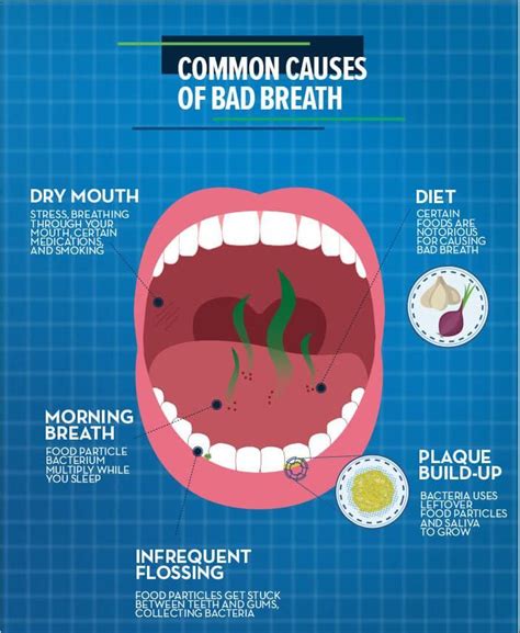 What Causes Bad Breath And How To Fix It - Pallara Dental - balustradellc