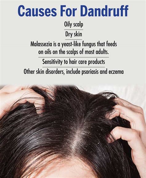 What Causes Dandruff, and How Can I Get Rid of It … - balustradellc