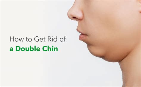 What Is a Double Chin Smile, and How to Get Rid of It - balustradellc