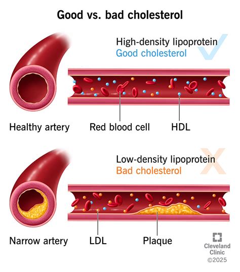 What is Cholesterol | How to Reduce Cholesterol | HDL and LDL - muktibox.com